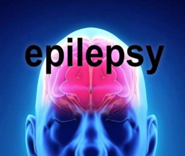 Epileptic Seizures